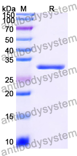 Recombinant Human PTPRQ Protein, N-His