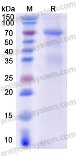 Recombinant Human FARSB Protein, N-His