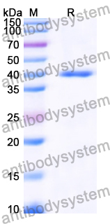 Recombinant Human SLC9A9 Protein, N-His-KSI