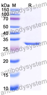 Recombinant Human ECRG4 Protein, N-His-KSI