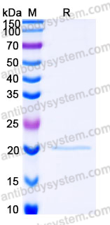 SDS-PAGE for Recombinant Human NIP7 Protein, N-His ?>