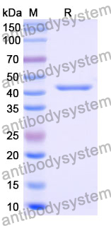 Recombinant Mouse CD300b/CD300LB Protein, N-GST & C-His