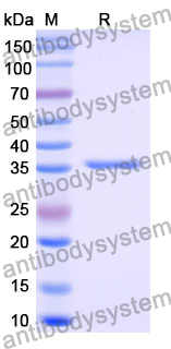 Recombinant Mouse CCL24/Eotaxin-2/MPIF-2 Protein, N-GST & C-His