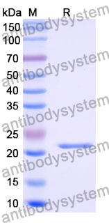 Recombinant Mouse MATN2 Protein, N-His