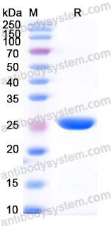 Recombinant Mouse QSOX1 Protein, N-His