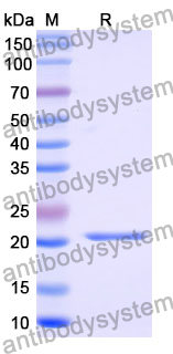 Recombinant Mouse DLL1 Protein, N-His