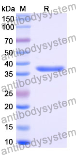 Recombinant Mouse PODXL Protein, N-GST & C-His