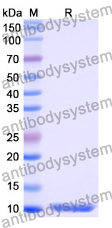 Recombinant Mouse CD267/TNFRSF13B Protein, N-His