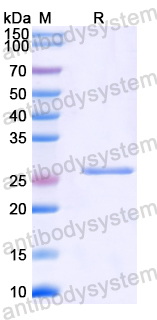 Recombinant Mouse ANGPT2/Ang2 Protein, N-His