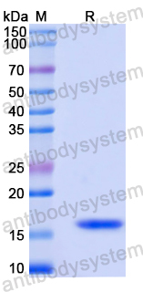 Recombinant Mouse CCL25/TECK Protein, N-His