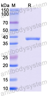 Recombinant Mouse FLRT2 Protein, N-His