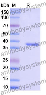Recombinant Mouse PSPN Protein, N-GST & C-His