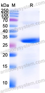 Recombinant Mouse SLIT3 Protein, N-His