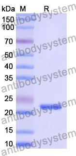 Recombinant Mouse CD335/NCR1/NKp46 Protein, N-His