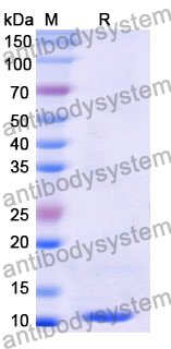 Recombinant Mouse DKK1 Protein, N-His