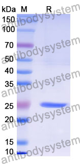 Recombinant Mouse CCN4/WISP-1 Protein, N-His-SUMO