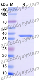 Recombinant Mouse CER1 Protein, N-GST & C-His