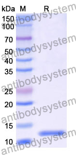 Recombinant Mouse IL18BP Protein, N-His