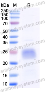 Recombinant Mouse TIMP1 Protein, N-His