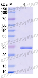 Recombinant Mouse PRL Protein, N-His