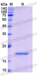 Recombinant Mouse TNFa/TNF-alpha Protein, N-His