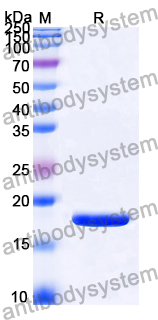 Recombinant Mouse IFNG/IFN-gamma Protein, N-His