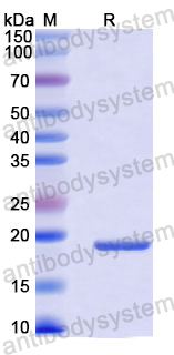 Recombinant Mouse IL1B/IL1F2 Protein, N-His