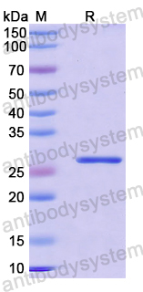 Recombinant Mouse PIGR Protein, N-His