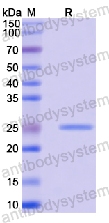 Recombinant Mouse APCS Protein, N-His