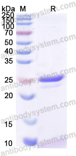 Recombinant Mouse ORM1/a1AGP Protein, N-His