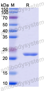 Recombinant Mouse S100A8 Protein, N-His-SUMO