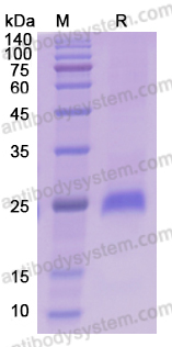 Recombinant Mouse IL6 Protein, C-His