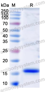 Recombinant Mouse S100A9 Protein, N-His