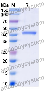 Recombinant Mouse FABP1 Protein, N-GST & C-His