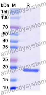 Recombinant Mouse CD141/THBD Protein, N-His