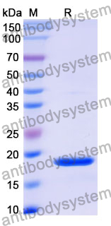 Recombinant Mouse ASGR2 Protein, N-His