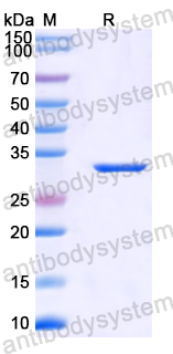 Recombinant Mouse CTSB Protein, N-His