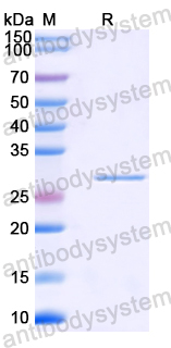 Recombinant Mouse RET/c-RET Protein, N-His