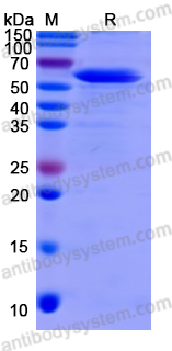 Recombinant Mouse MMP2 Protein, N-His