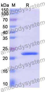 Recombinant Mouse MMP3 Protein, N-His
