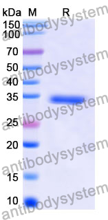 Recombinant Mouse CD14 Protein, N-His