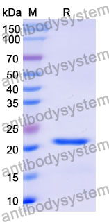 Recombinant Mouse CFH Protein, N-His