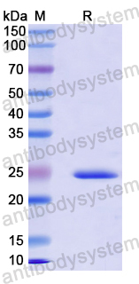 Recombinant Mouse IGFBP1 Protein, N-His-SUMO