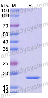 Recombinant Mouse FGF2/bFGF Protein, N-His