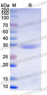 Recombinant Mouse CSF1/M-CSF Protein, N-His