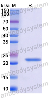 Recombinant Mouse CD140b/PDGFRB Protein, N-His