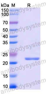 Recombinant Mouse CTSH Protein, N-His