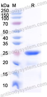 Recombinant Mouse SAA1 Protein, N-His-SUMO
