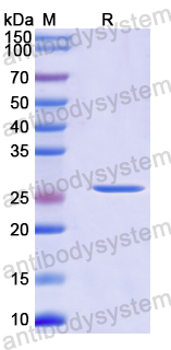 Recombinant Mouse GZMB Protein, N-His