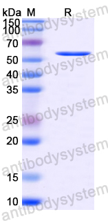 Recombinant Mouse CD117/KIT Protein, N-His